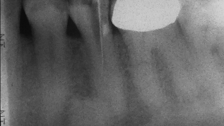 3D Endo™ Software – Sicherheit durch Planung