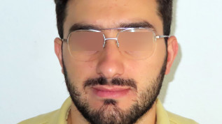 Möglichkeiten und Grenzen der kieferorthopädischen Camouflage-Behandlung (Teil 1) Patienten mit skelettaler Klasse III