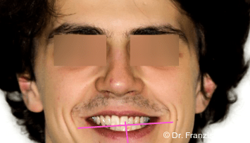 firstGalleryImage