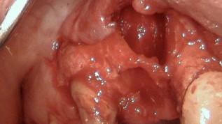 Einfluss biologischer und technischer Faktoren auf den Implantaterfolg