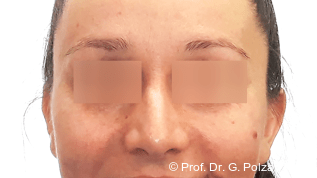 Der Sunday Bite als diagnostische Falle