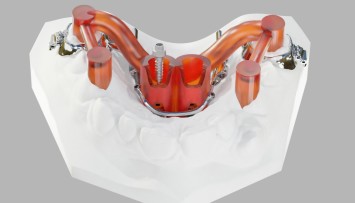 firstGalleryImage