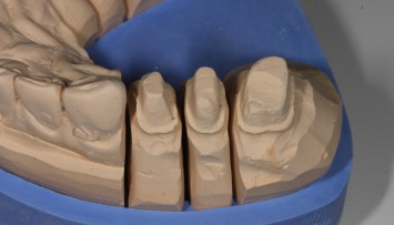 firstGalleryImage