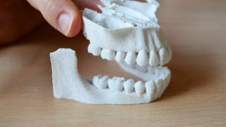 3D-Druck – wirklicher Vorteil oder digitaler Hype?