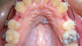 Orthodontist Zurich