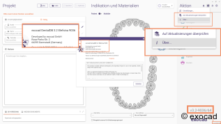 exocad Credits für die neuen DentalCAD KI-gestützten Services