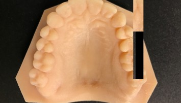firstGalleryImage
