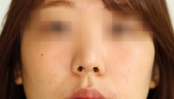firstGalleryImage