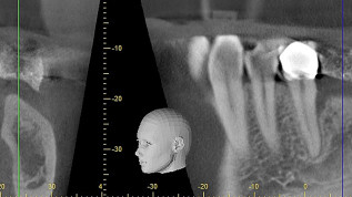 Vereinfachte 3D-Augmentationen mit CAD und modernen Materialien