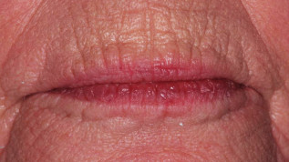 Der Umgang mit komplexen ästhetischen Wünschen im Alter