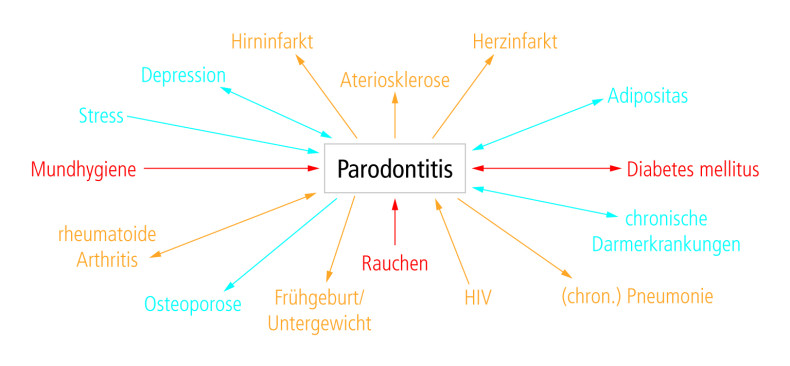 Zusammenhang Zwischen Mund- Und Allgemeinerkrankungen – ZWP Online ...