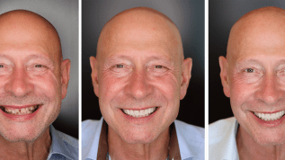 The Facial Aesthetic Concept: Ein neuer Ansatz in der dentalen Gesamtrehabilitation