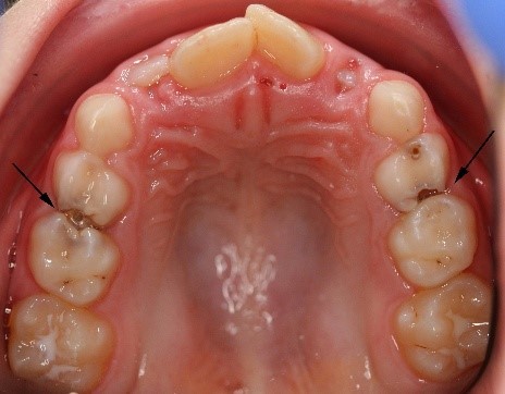 Tipps Zur Mundgesundheit Bei Grundschulern Zwp Online Das Nachrichtenportal Fur Die Dentalbranche