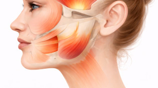 Botulinumtoxin in der maxillofazialen Chirurgie: Potenziale, Grenzen und klinische Relevanz