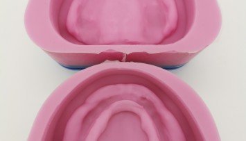firstGalleryImage