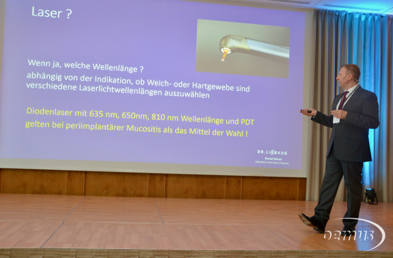 Dr. Frank Liebaug im Vortrag “Entzündungen am Implantat – können
laserbasierte Therapiekonzepte helfen?
30 Jahre klinische Erfahrung und
Wissenschaft“