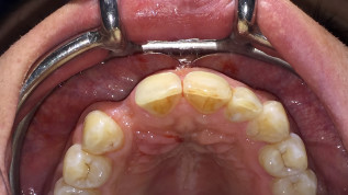 Moderne Augmentationskonzepte – Bewährtes und Neues