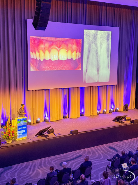 Prof. Dr. Kerstin Galler sprach zur Pulpadiagnistik.