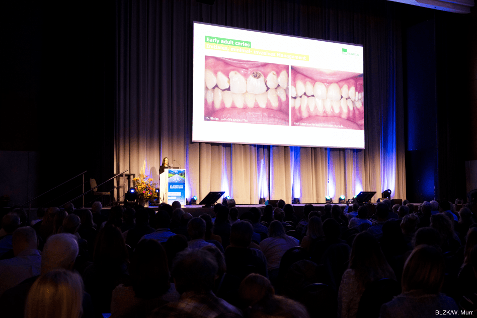 Dr. Helen Schill stellte das Phänomen Early Adult Caries vor.