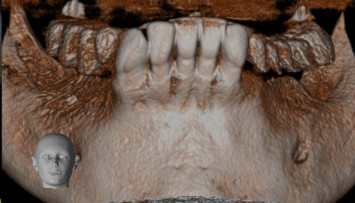 firstGalleryImage