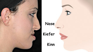 Kieferorthopädische Therapie: Die ästhetische Achse