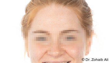 firstGalleryImage