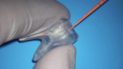 Perfekter Verschluss mit CeraSeal